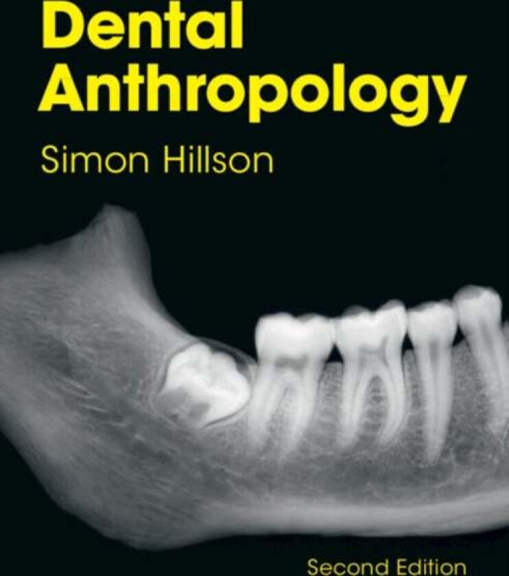Dental Anthropology av Simon (University College London) Hillson