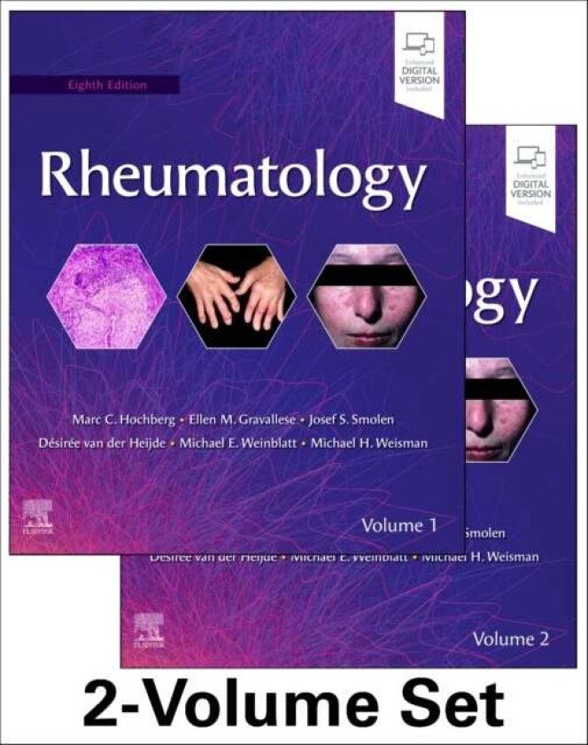 Bilde av Rheumatology, 2-Volume Set