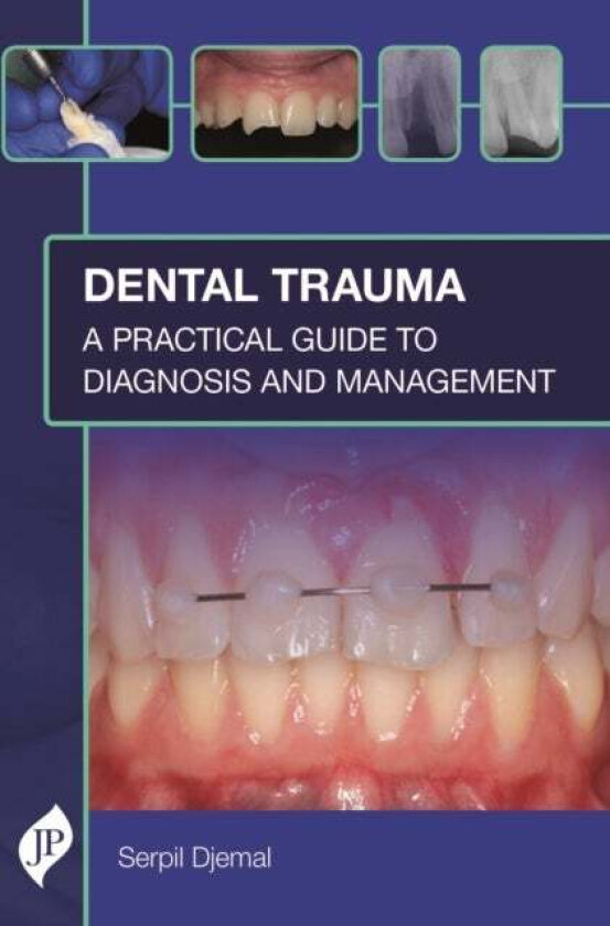 Dental Trauma av Serpil Djemal