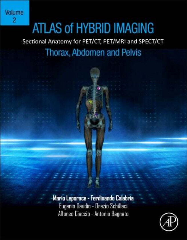 Atlas of Hybrid Imaging Sectional Anatomy for PET/CT, PET/MRI and SPECT/CT Vol. 2: Thorax Abdomen an av Mario (Clinical Radiologist Cosenza Hospital I