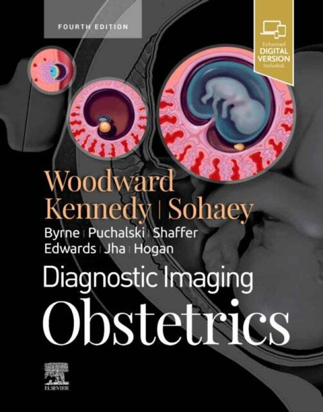Diagnostic Imaging: Obstetrics av Paula J. (Professor in the Department of Radiology and Adjunct Professor of Obstetrics and Gynecology at the Univers