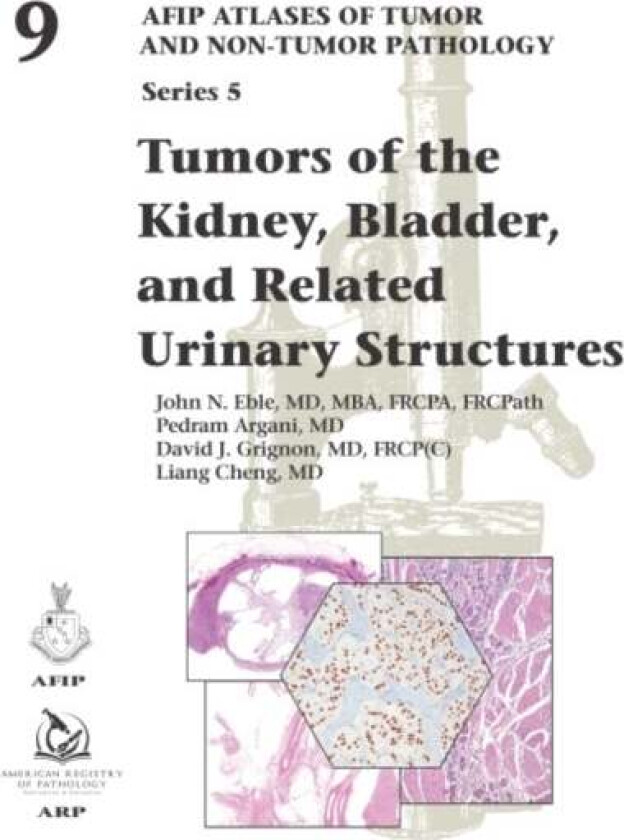 Tumors of the Kidney, Bladder, and Related Urinary Structures av John Eble, Pedram Argani, Liang Cheng, David J. Grignon