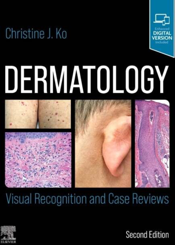 Dermatology: Visual Recognition and Case Reviews av Christine (Professor of Dermatology and Pathology Yale Medical School New Haven CT USA) Ko