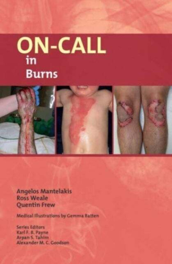 On-Call in Burns av Angelos Mantelakis, Ross Weale, Quentin Frew