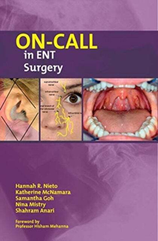 On-Call in ENT Surgery av Hannah Nieto, Katherine McNamara, Samantha Goh, Nina Mistry, Shahram Anari