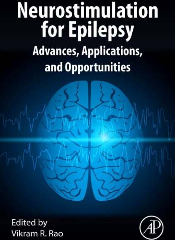 Neurostimulation for Epilepsy