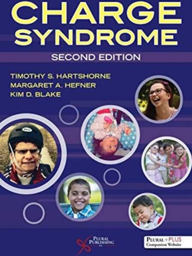 CHARGE Syndrome