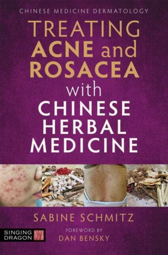 Treating Acne and Rosacea with Chinese Herbal Medicine av Sabine Schmitz