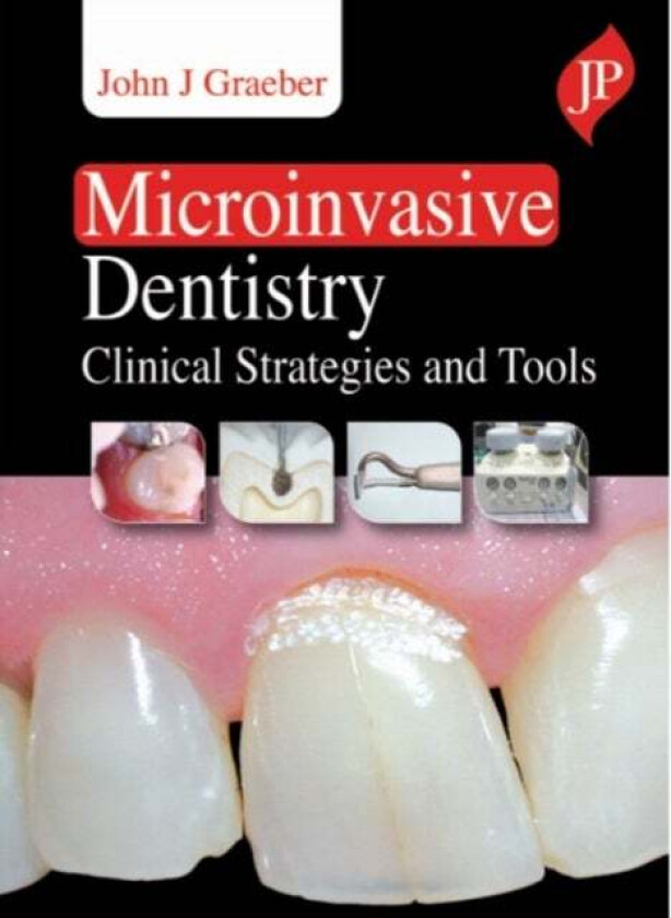 Microinvasive Dentistry av John J Graeber