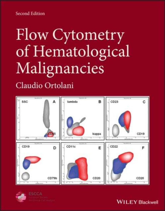 Flow Cytometry of Hematological Malignancies av Claudio (Consultant Clinical Pathologist (retired) Ospedale dell'Angelo Venice Italy) Ortolani