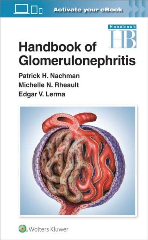 Handbook of Glomerulonephritis av Patrick Nachman, Edgar Lerma, Michelle Rheault