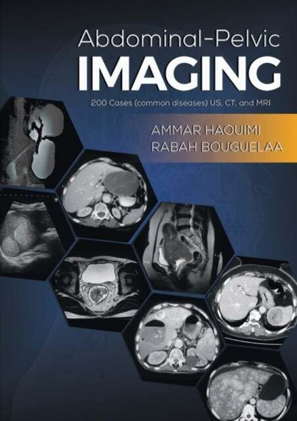 Abdominal-Pelvic Imaging av Ammar Haouimi, Rabah Bouguelaa