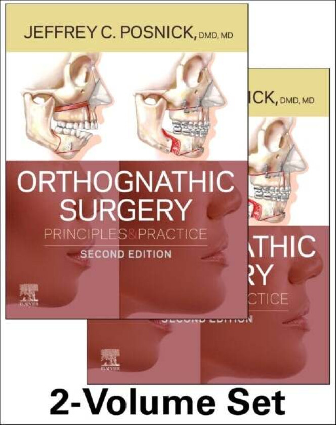 Orthognathic Surgery - 2 Volume Set av Jeffrey C. Posnick