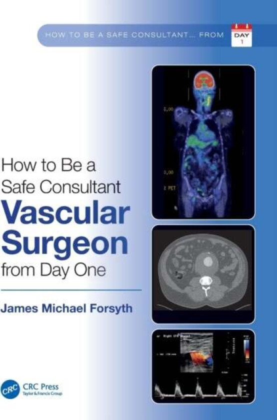 How to be a Safe Consultant Vascular Surgeon from Day One av James Forsyth
