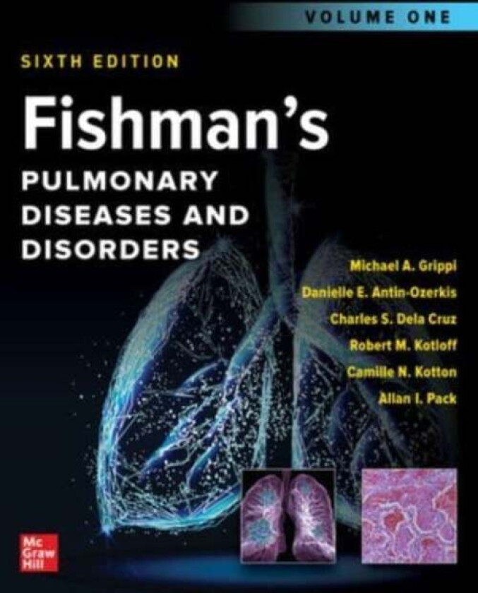 Fishman's Pulmonary Diseases and Disorders, 2-Volume Set, Sixth Edition av Michael Grippi, Danielle E. Antin-Ozerkis, Charles S. Dela Cruz, Rober