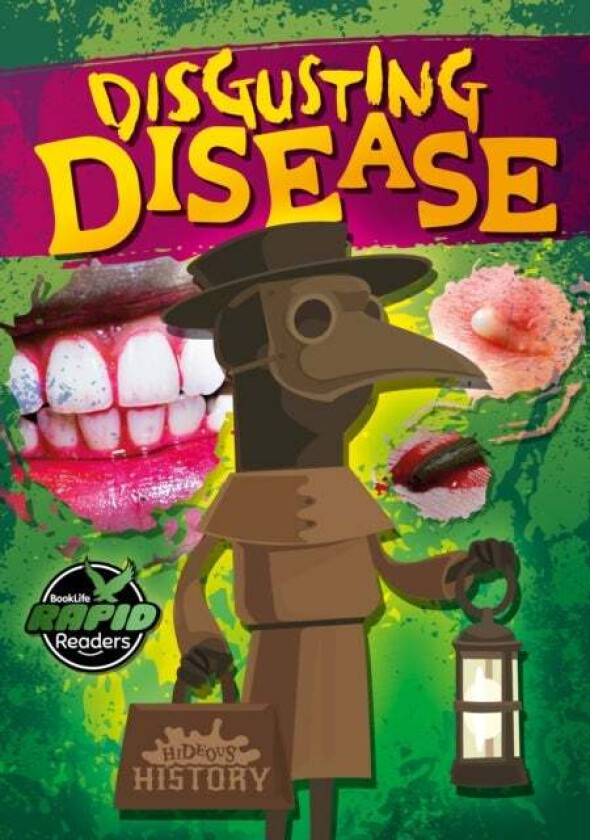 Disgusting Disease av William Anthony