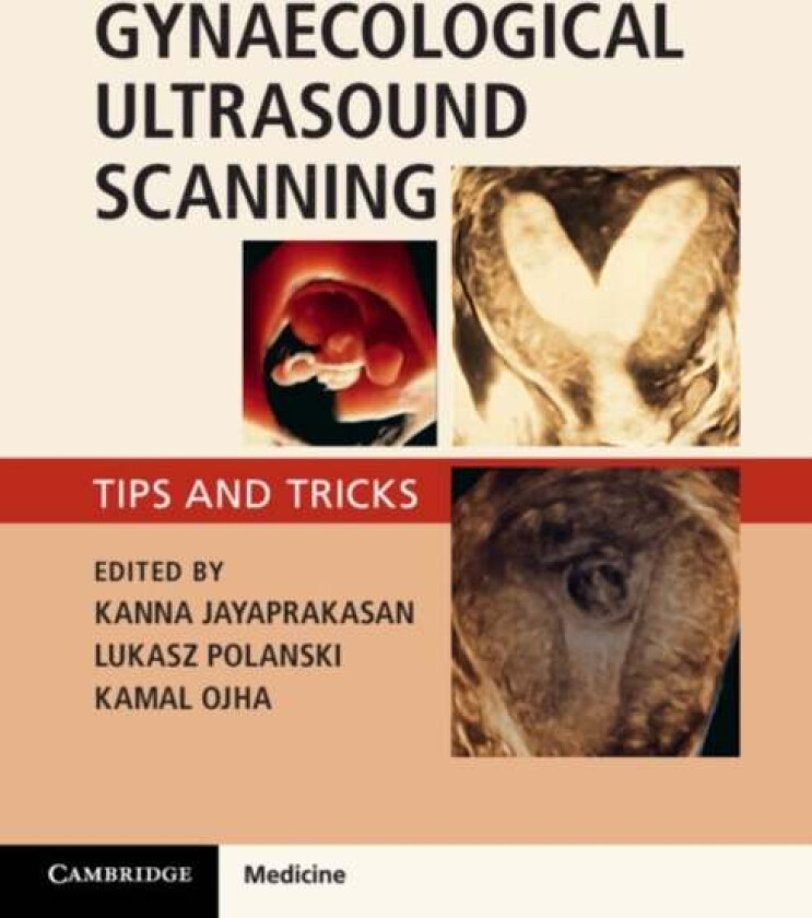 Gynaecological Ultrasound Scanning av Kanna Jayaprakasan, Lukasz Polanski, Kamal Ojha