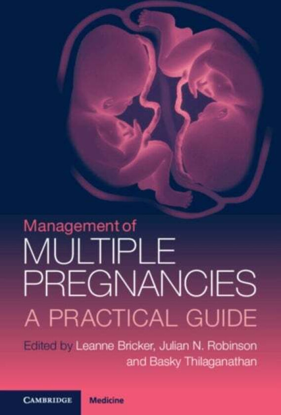 Management of Multiple Pregnancies