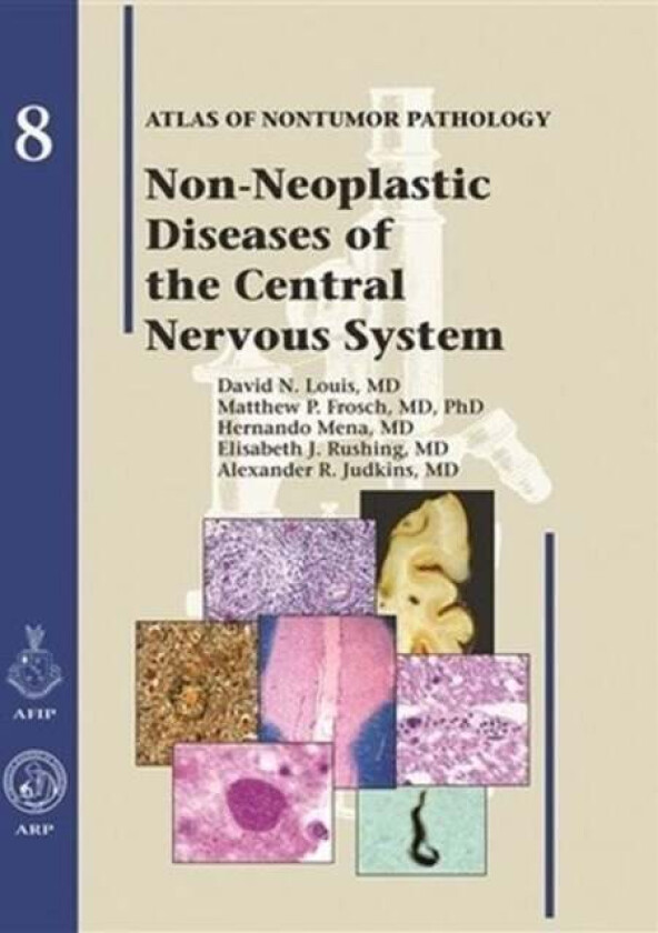 Non-Neoplastic Diseases of the Central Nervous System av David N. Louis, Matthew P. Frosch, Hernando Mena, Elisabeth J. Rushing, Alexander R. Judkins