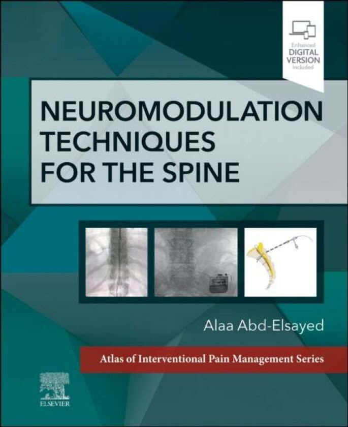 Neuromodulation Techniques for the Spine av Alaa MD MPH FASA (Medical Director UW Pain Clinic Division Chief Chronic Pain Medicine University of Wisco
