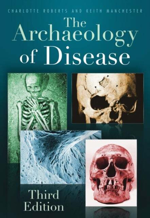 The Archaeology of Disease av Charlotte Roberts, Keith Manchester