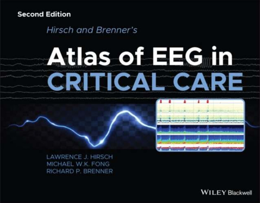 Hirsch and Brenner's Atlas of EEG in Critical Care av Lawrence J. (Yale University School of Medicine New Haven CT USA) Hirsch, Michael W. K. (Th