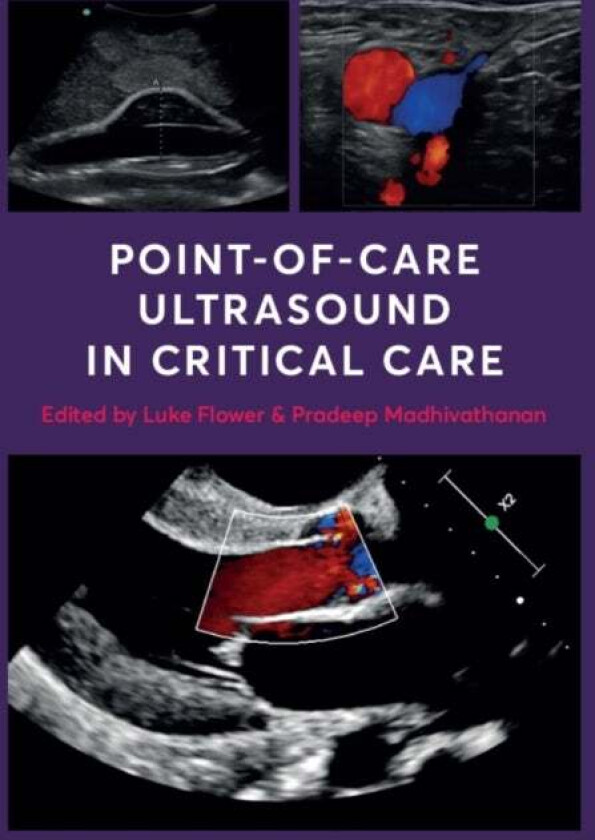 Point-of-Care Ultrasound in Critical Care