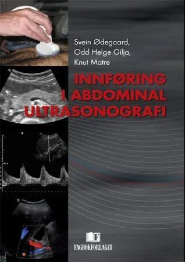Innføring i abdominal ultrasonografi av Odd Helge Gilja, Knut Matre, Svein Ødegaard