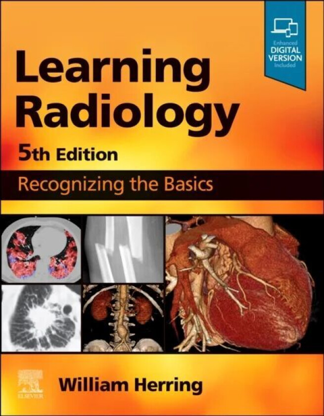 Learning Radiology av William (Vice Chairman and Residency Program Director Albert Einstein Medical Center Philadelphia PA) Herring