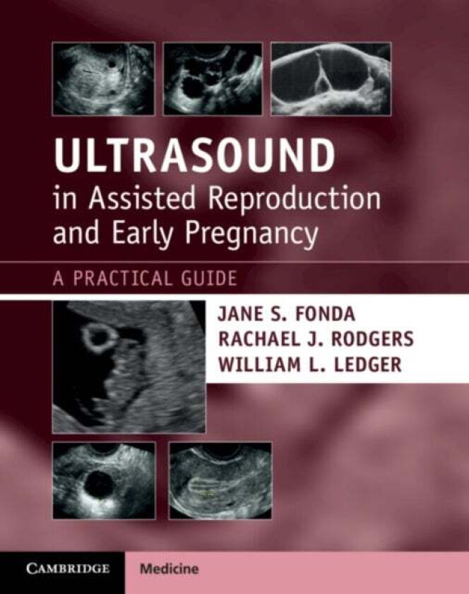 Ultrasound in Assisted Reproduction and Early Pregnancy av Jane S. (University of Sydney) Fonda, Rachael J. Rodgers, William L. (University of New Sou