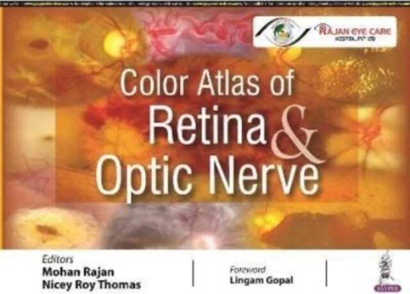 Color Atlas of Retina & Optic Nerve av Mohan Rajan, Nicey Roy Thomas