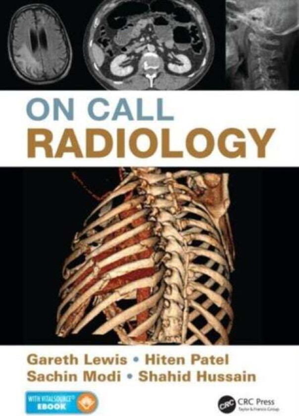 On Call Radiology av Gareth Lewis, Sachin Modi, Hiten Patel, Hussain