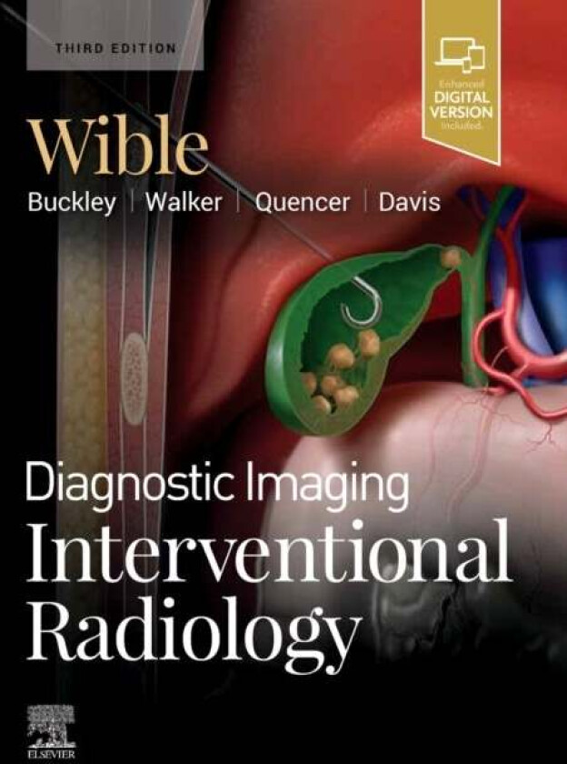 Diagnostic Imaging: Interventional Radiology av Brandt C. (Associate Professor Section Head Vascular & Interventional Radiology University of Miss