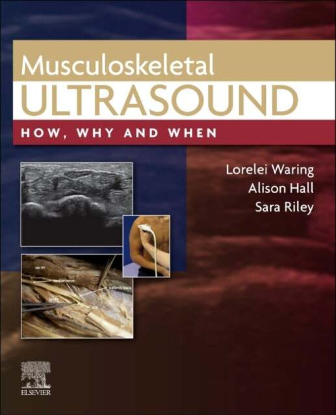 Musculoskeletal Ultrasound av Lorelei DCR (R) PgC AP MSc Medical Ultrasound FHEA (Senior Lecturer Department of Medical Sciences Institute of Health U