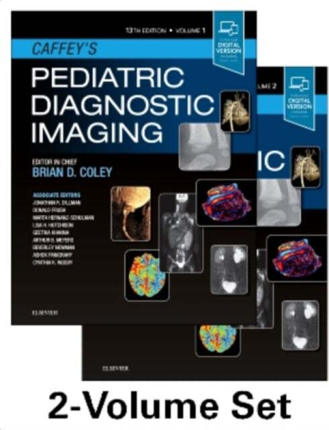 Caffey's Pediatric Diagnostic Imaging, 2-Volume Set av Brian D. (Professor Departments of Radiology and Pediatrics University of Cincinnati Colle