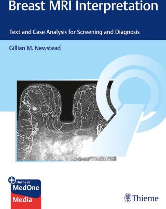 Breast MRI Interpretation av Gillian M. Newstead