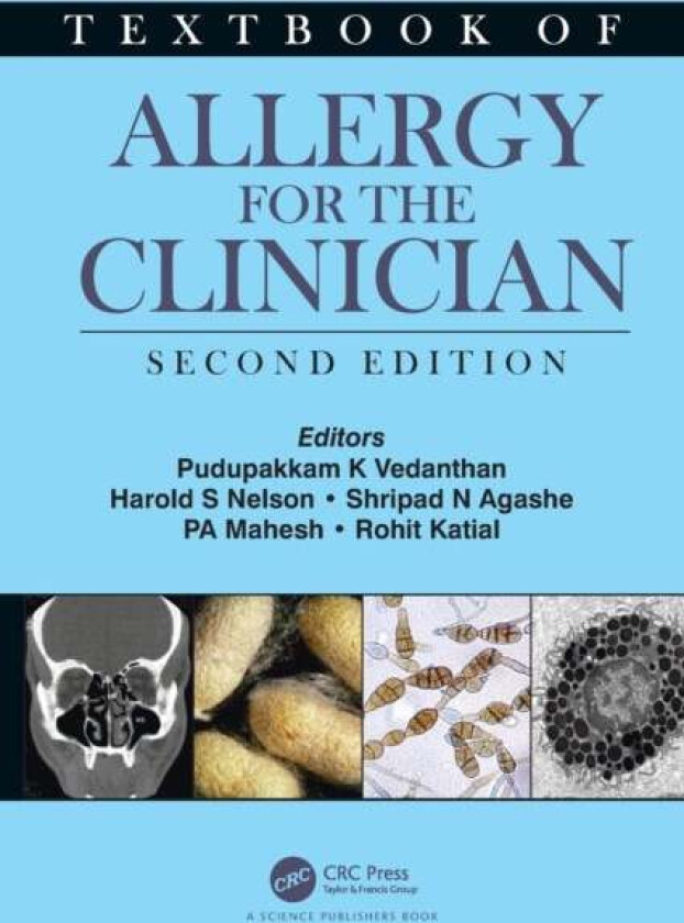 Textbook of Allergy for the Clinician