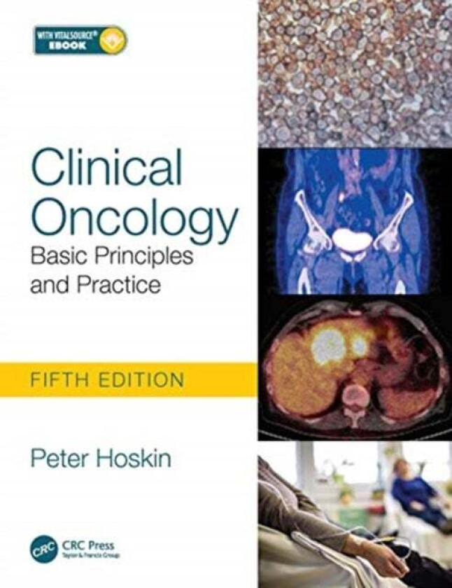 Clinical Oncology av Peter (University of Manchester Manchester UK Mount Vernon Hospital Northwood London UK University College London Hospitals Londo