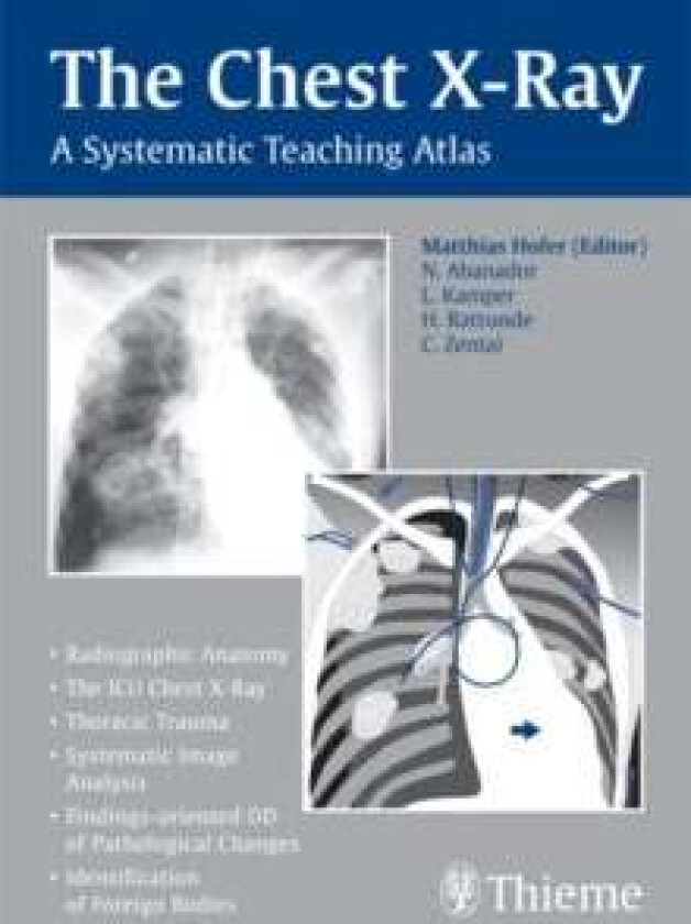 The Chest X-Ray av Matthias Hofer
