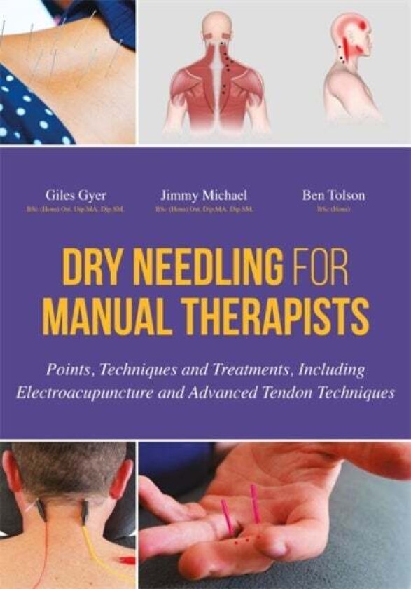 Dry Needling for Manual Therapists av Giles Gyer, Jimmy Michael, Ben Tolson