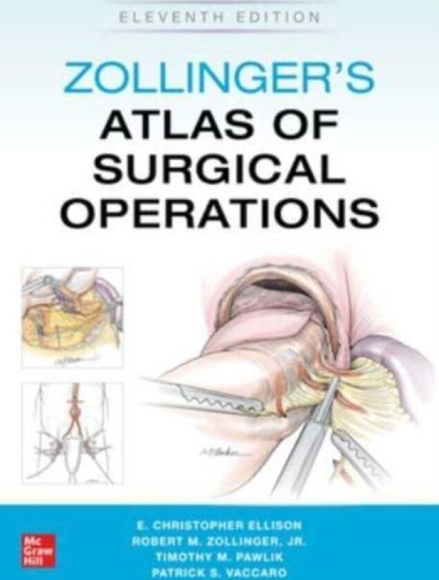 Zollinger's Atlas of Surgical Operations, Eleventh Edition av Robert Zollinger, E. Ellison, Timothy Pawlik, Patrick Vaccaro