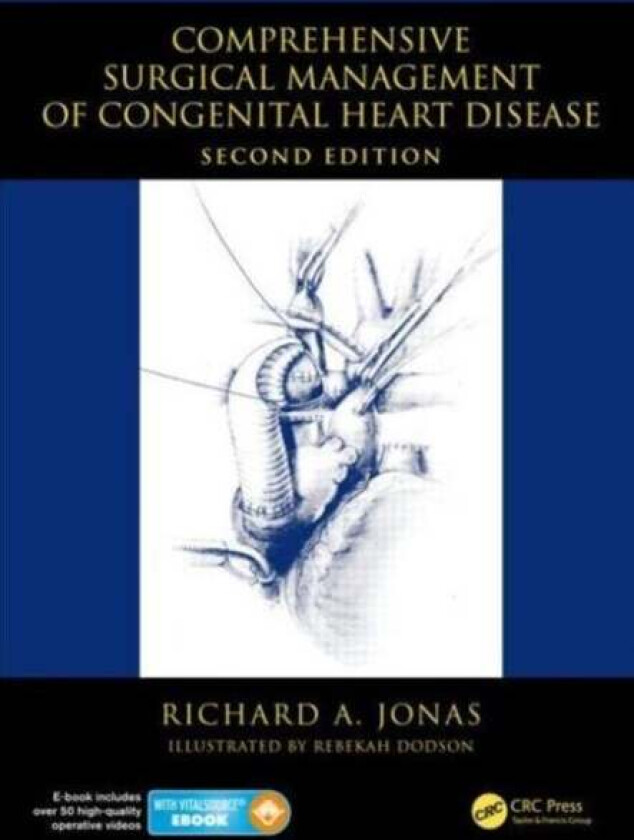Comprehensive Surgical Management of Congenital Heart Disease av Richard A Jonas