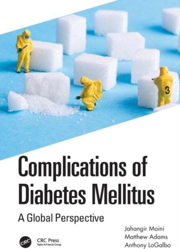 Complications of Diabetes Mellitus av Jahangir (Eastern Florida State College USA) Moini, Matthew (Florida Eye Associates Florida USA) Adams, Anthony