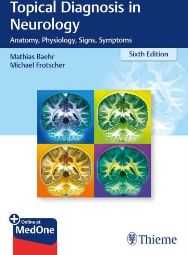 Topical Diagnosis in Neurology av Mathias Bahr, Michael Frotscher