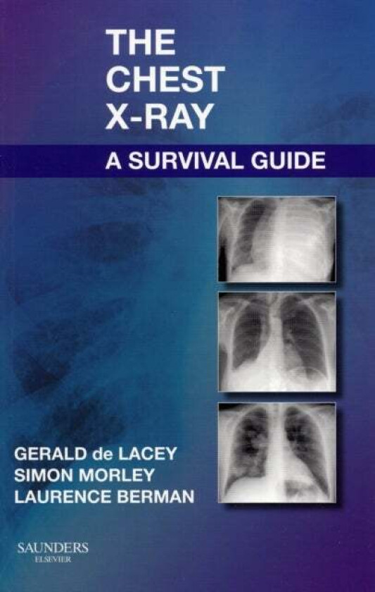 The Chest X-Ray: A Survival Guide av Gerald MA FRCR (Consultant Radiologist to www.radiology-courses.com and formerly Consultant Radiologist at Northw