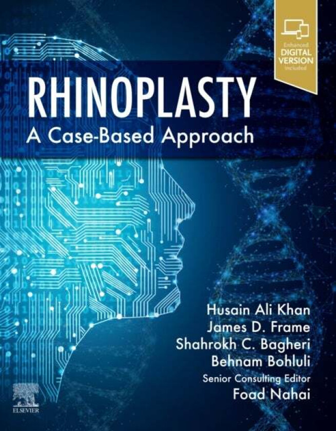 Rhinoplasty av Husain Ali (Oral and Maxillofacial Surgeon Georgia Oral and Facial Reconstructive Surgery Alpharietta Georgia) Khan, Foad M.D. (Clinica