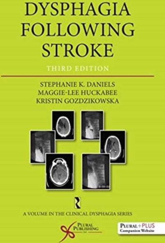 Dysphagia Following Stroke av Stephanie K. Daniels, Maggie Lee Huckabee, Kristin Gozdzikowska