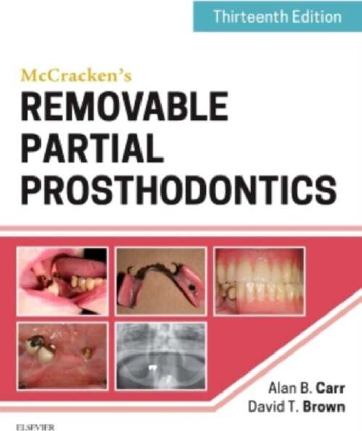 McCracken's Removable Partial Prosthodontics av Alan B. (Prosthodontic Consultant and Professor of Dentistry in the Department of Dental Specialt