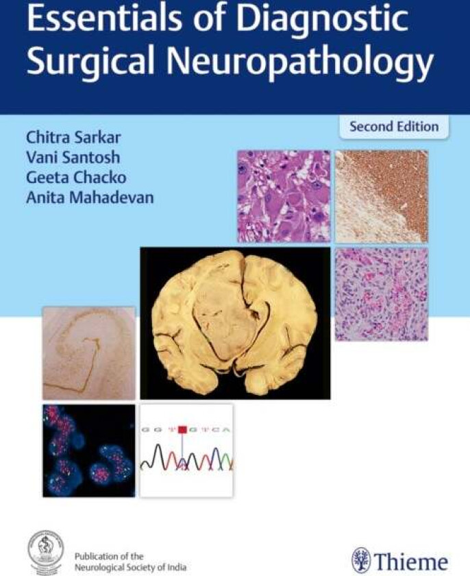 Essentials of Diagnostic Surgical Neuropathology