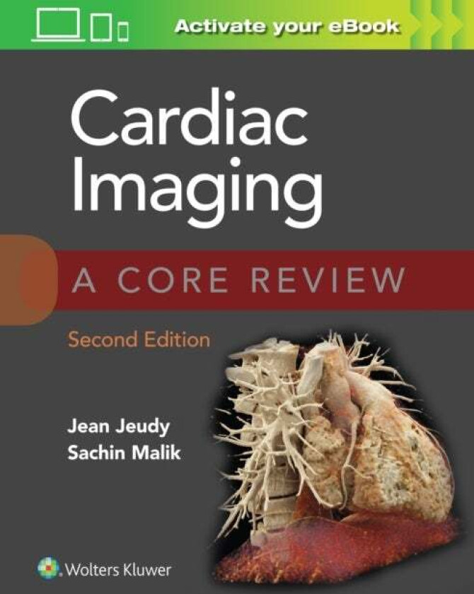Cardiac Imaging: A Core Review av Jean Jeudy, Sachin Basiq Malik